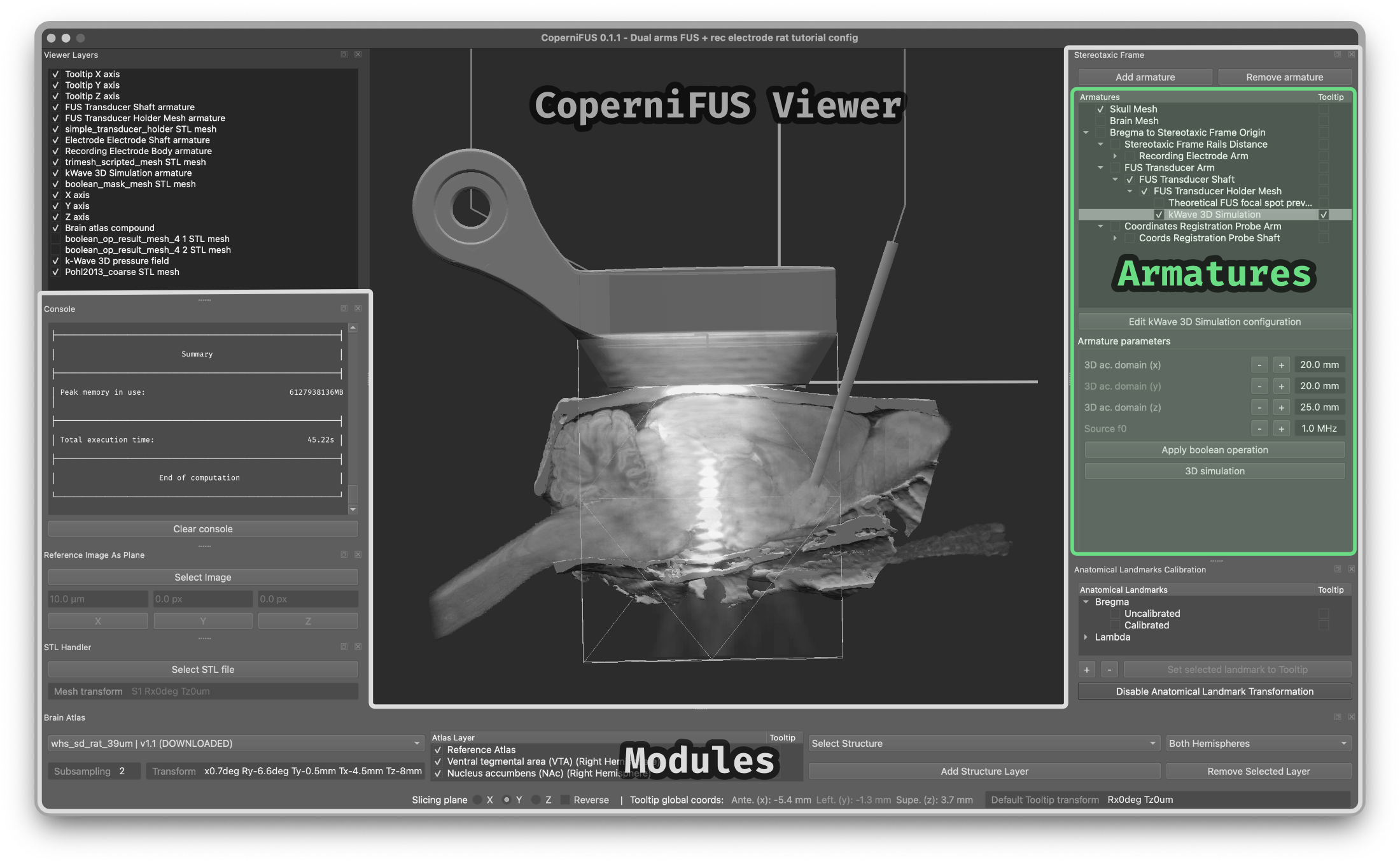 _images/CoperniFUS_ui_breakdown_armatures.png