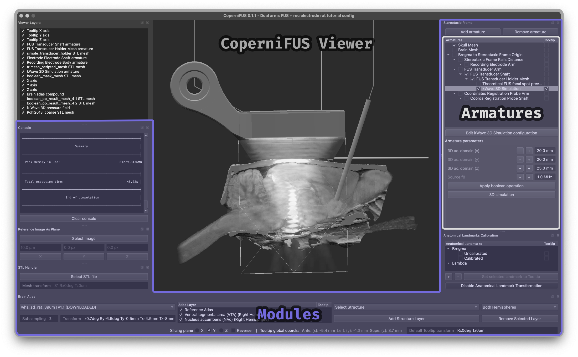 _images/CoperniFUS_ui_breakdown_modules.png