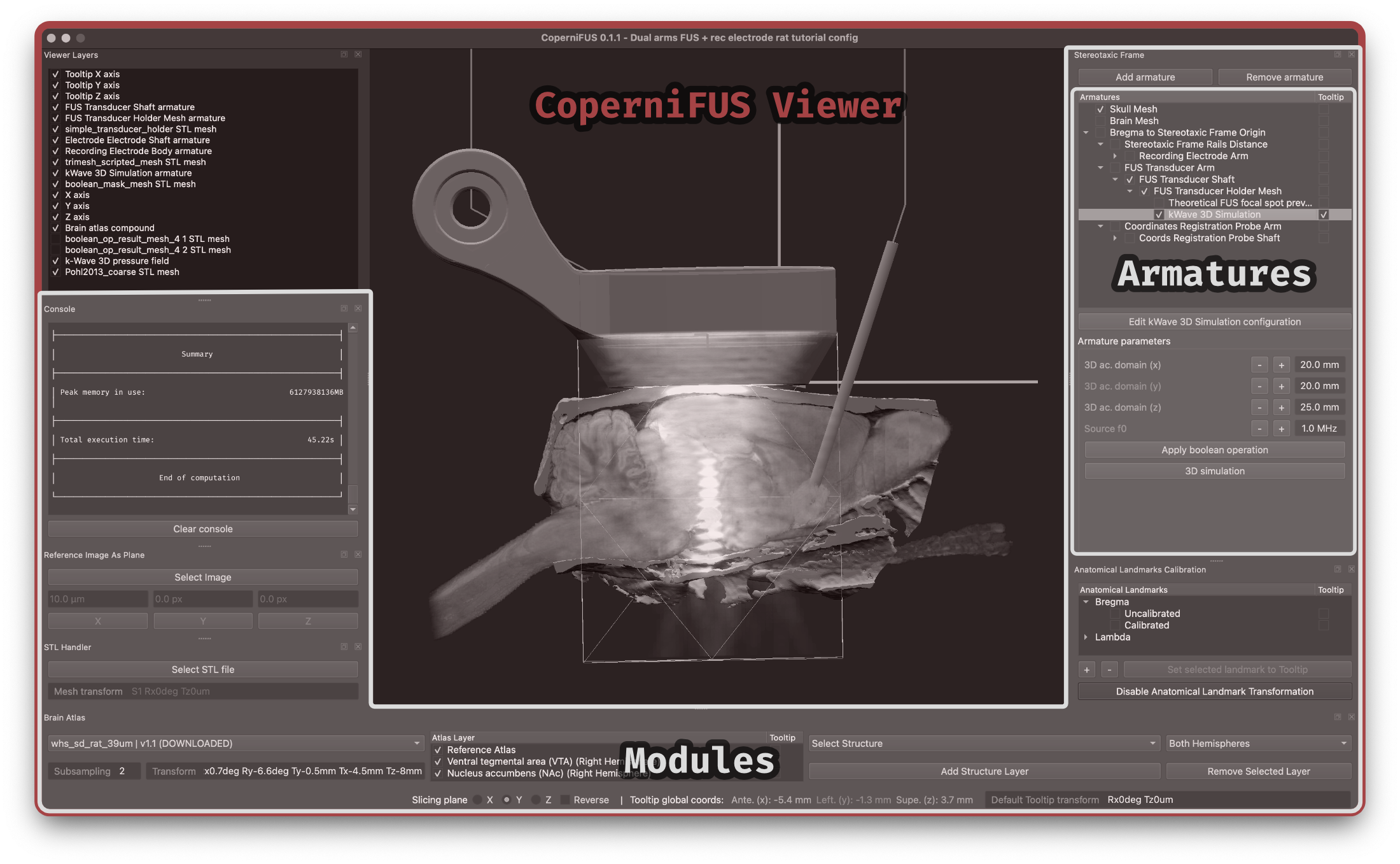 _images/CoperniFUS_ui_breakdown_viewer.png