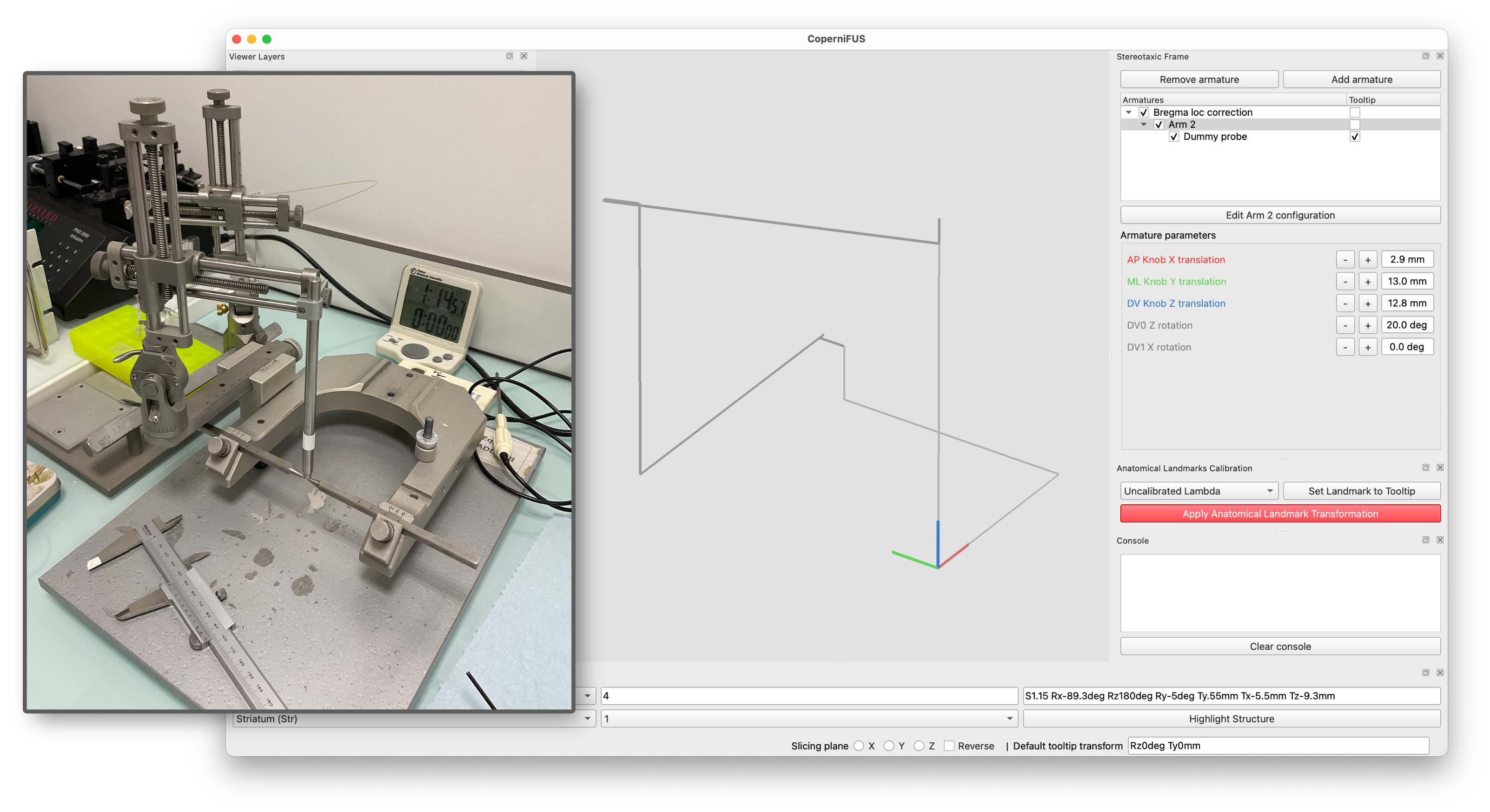 _images/armature_validation_dv0_angle.png