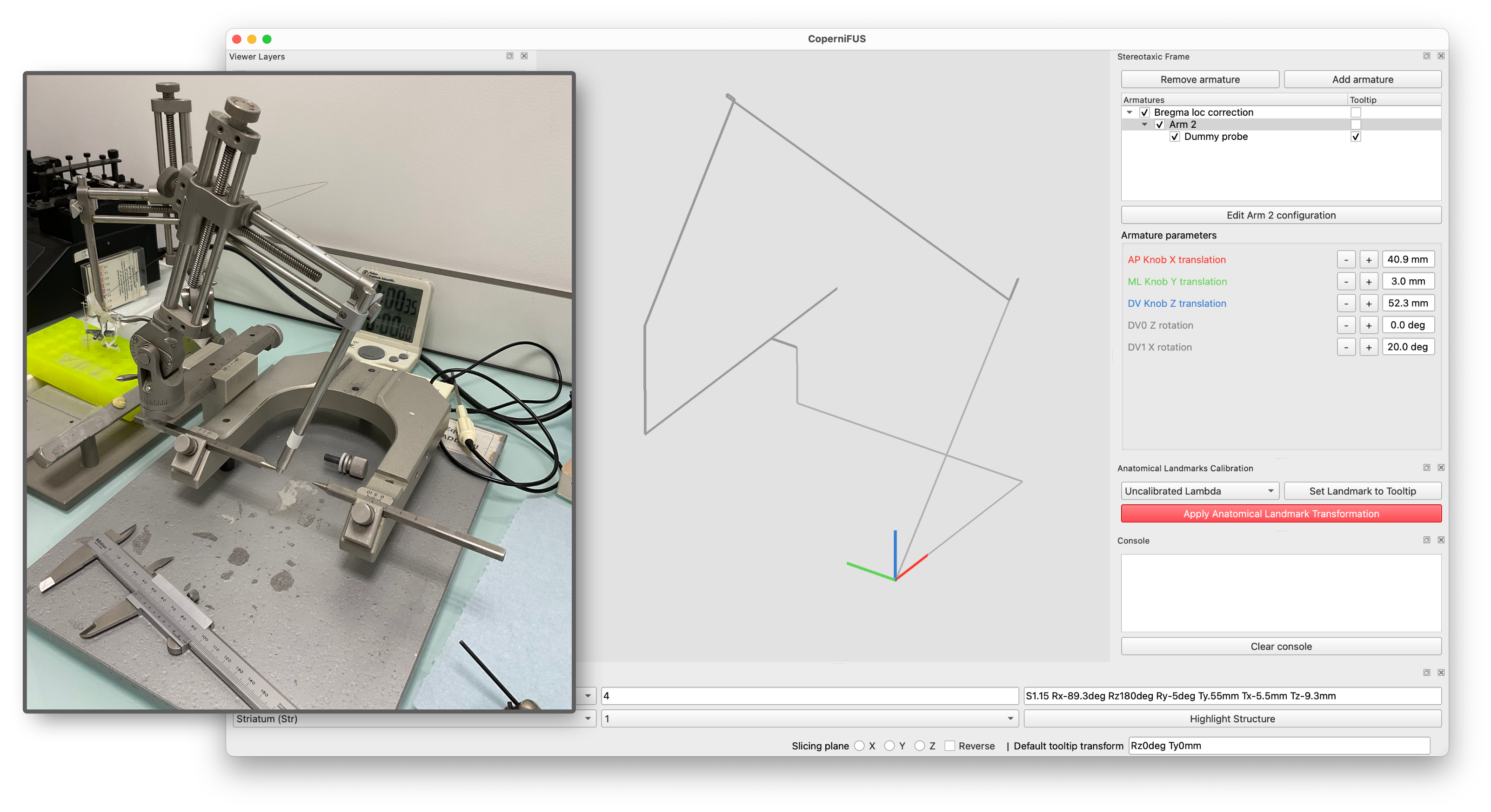 _images/armature_validation_dv1_angle.png
