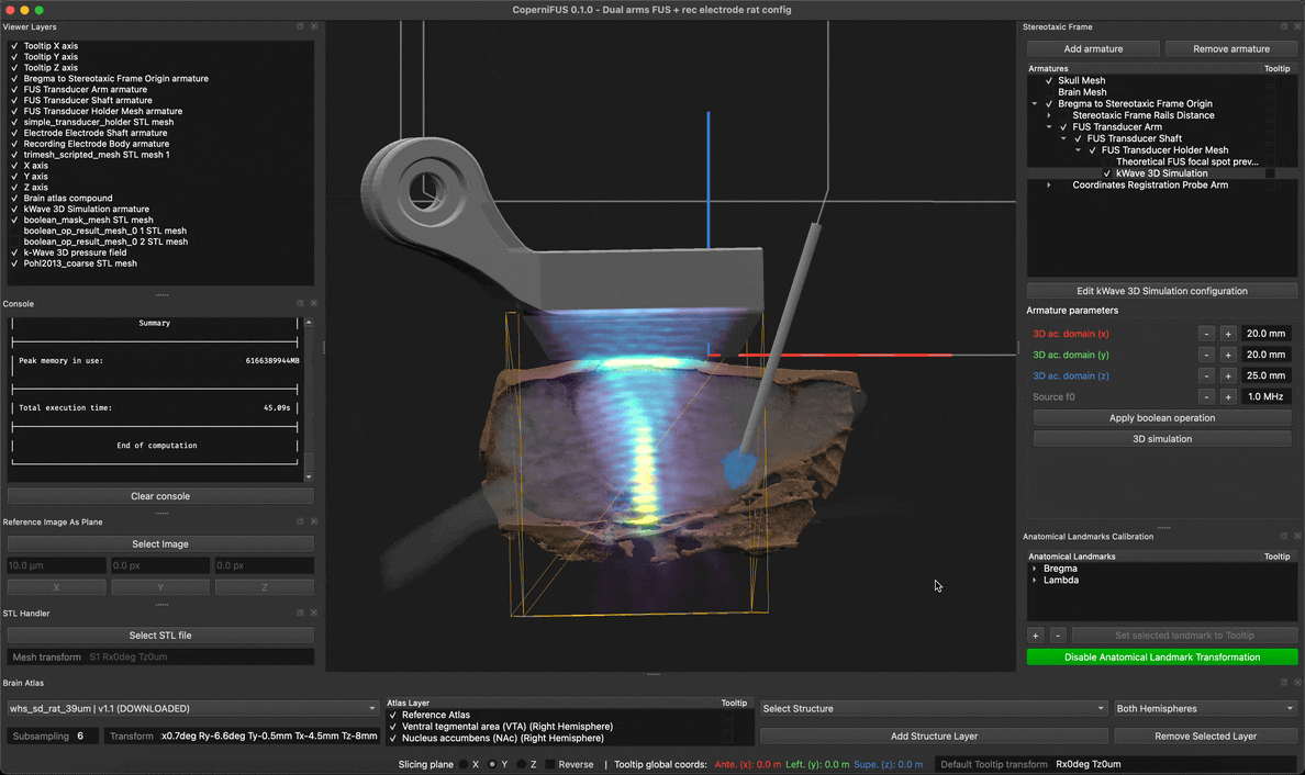 ../_images/tuto_kwave_sim_result.gif